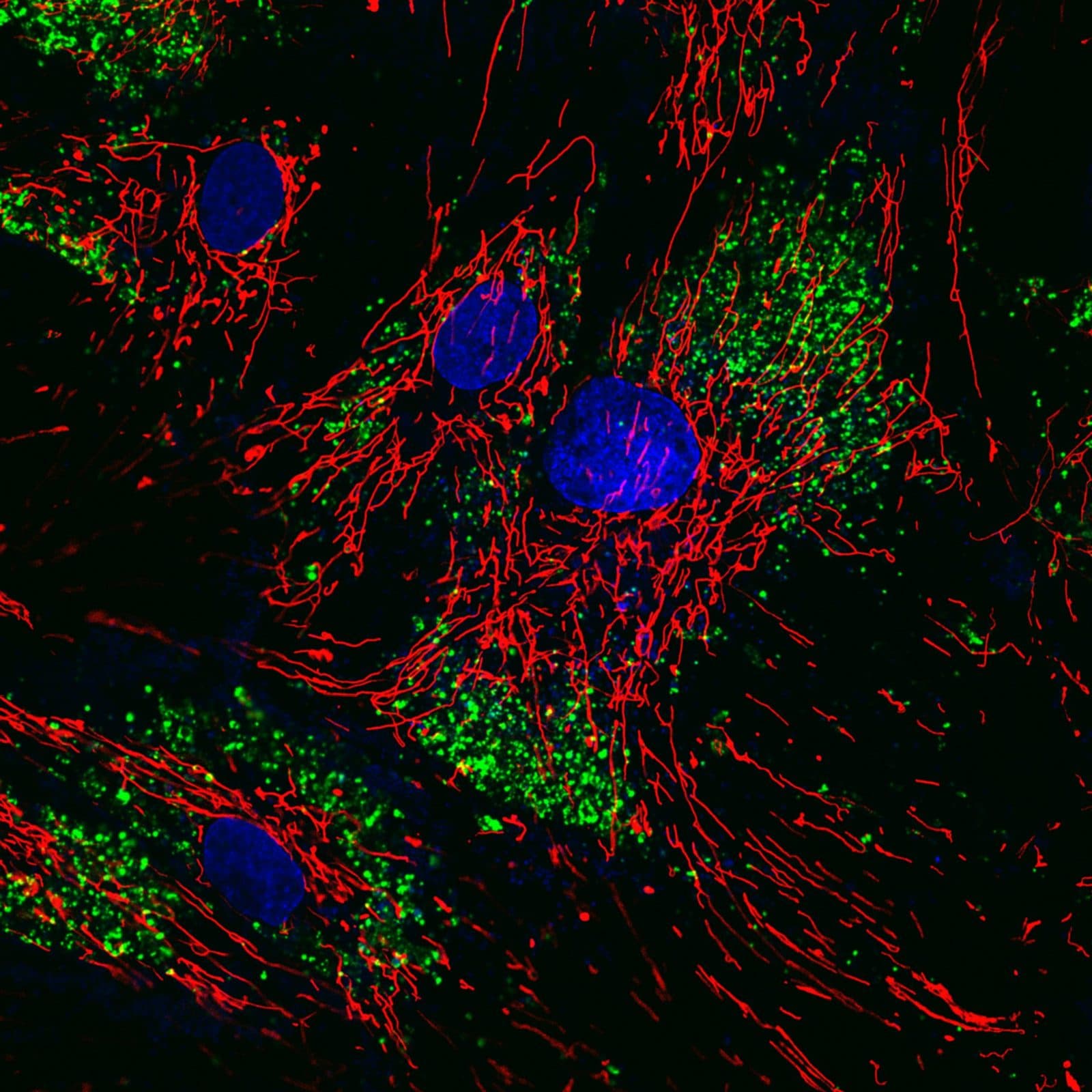 Human fibroblasts, fluorescence: mitochondria in red, nuclei in blue, nanoparticles in green