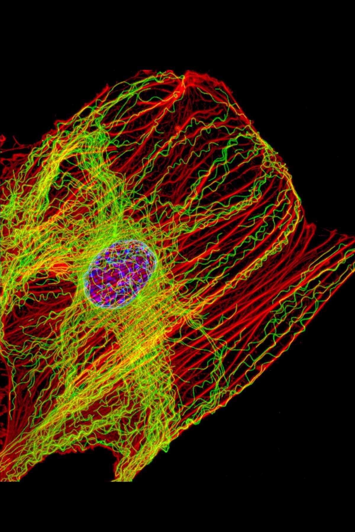 Un fibroblasto, fluorescencia: actina en rojo, microtúbulos en verde