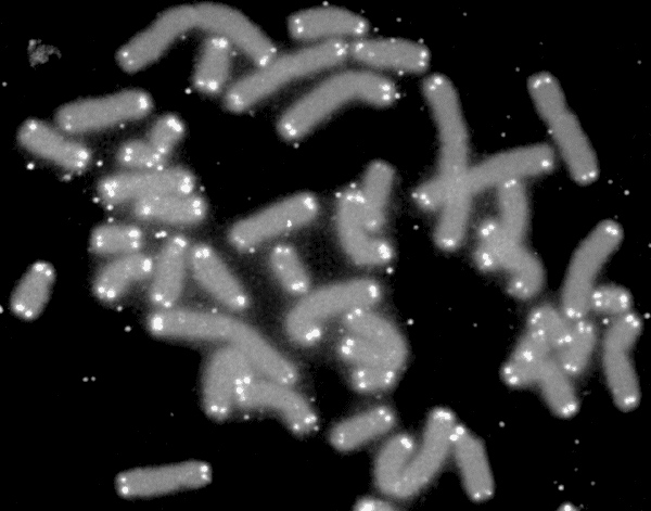 Human chromosomes (grey) with telomeres lit at their tips (white)